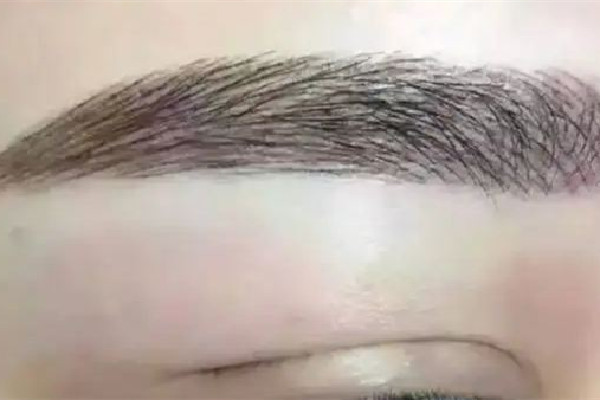 激光洗眉用什么机器最好，激光洗眉用不用刮眉毛