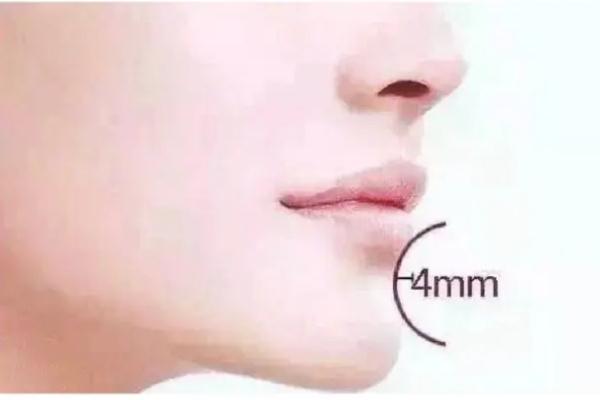 玻尿酸丰下巴后遗症，玻尿酸丰下巴多久恢复自然