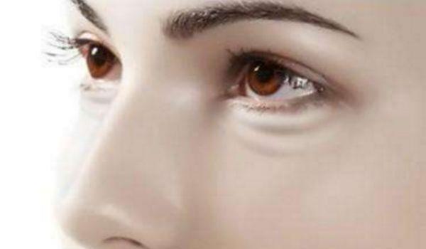 怎样才能有效去除眼袋黑眼圈，怎么有效去眼袋黑眼圈