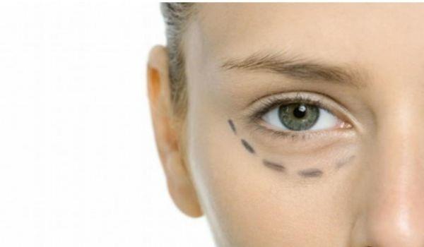 怎样去眼袋和黑眼圈，祛黑眼圈和眼袋的方法