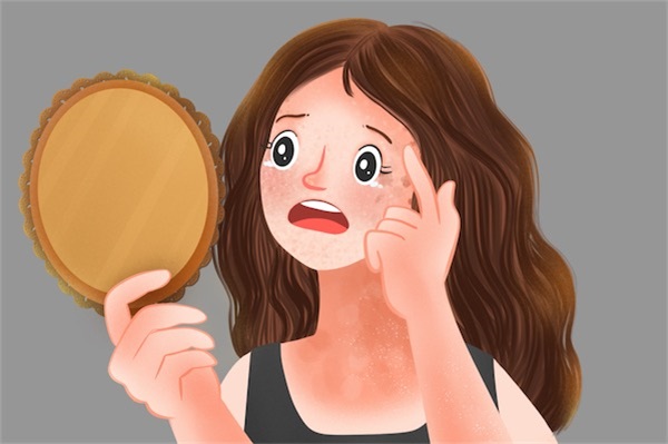 脱皮用蛋清面膜好吗