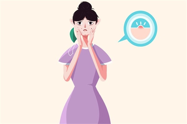 有粉刺可不可以用润面霜